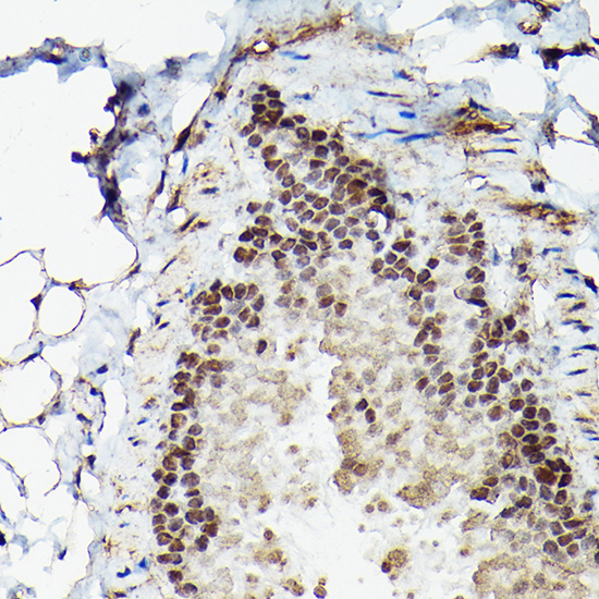 Immunohistochemistry of paraffin-embedded mouse lung using Fam50b Polyclonal Antibody at dilution of 1:50 (40x lens).Perform high pressure antigen retrieval with 10 mM citrate buffer pH 6.0 before commencing with IHC staining protocol.