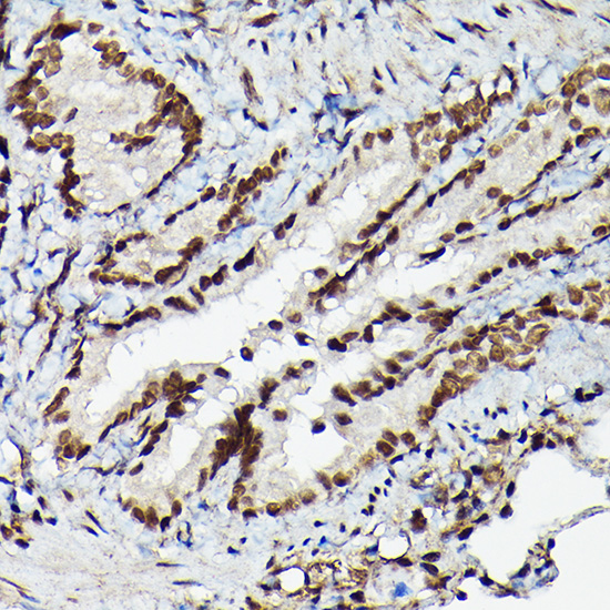 Immunohistochemistry of paraffin-embedded rat lung using Fam50b Polyclonal Antibody at dilution of 1:50 (40x lens).Perform high pressure antigen retrieval with 10 mM citrate buffer pH 6.0 before commencing with IHC staining protocol.