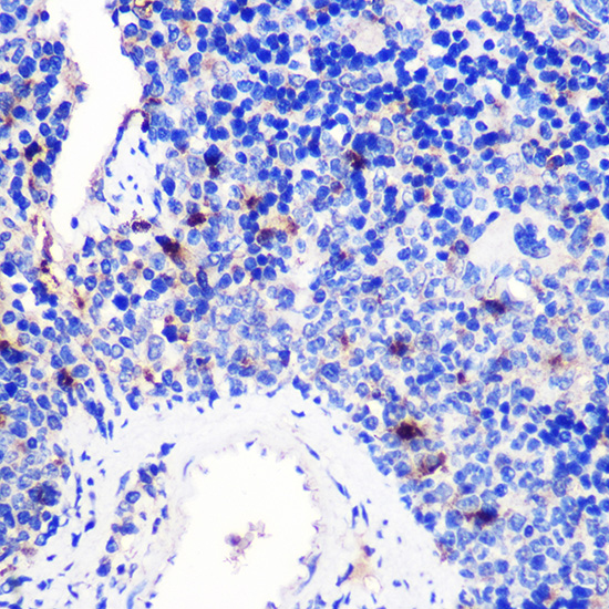 Immunohistochemistry of paraffin-embedded Mouse spleen using 4-1BB/CD137 Polyclonal Antibody at dilution of 1:100 (40x lens).Perform microwave antigen retrieval with 10 mM PBS buffer pH 7.2 before commencing with IHC staining protocol.