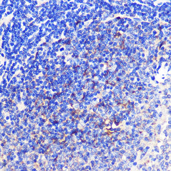 Immunohistochemistry of paraffin-embedded Rat spleen using 4-1BB/CD137 Polyclonal Antibody at dilution of 1:100 (40x lens).Perform microwave antigen retrieval with 10 mM PBS buffer pH 7.2 before commencing with IHC staining protocol.