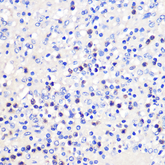 Immunohistochemistry of paraffin-embedded Human spleen using 4-1BB/CD137 Polyclonal Antibody at dilution of 1:100 (40x lens).Perform microwave antigen retrieval with 10 mM PBS buffer pH 7.2 before commencing with IHC staining protocol.