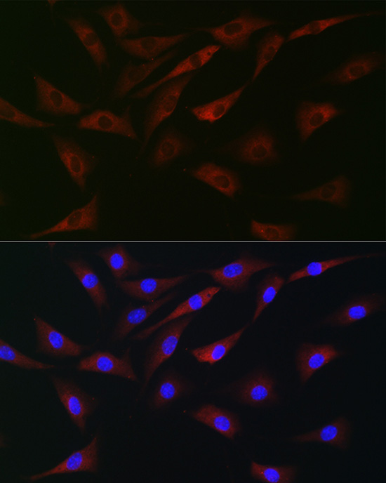 Immunofluorescence analysis of NIH-3T3 cells using eIF4A Polyclonal Antibody at dilution of 1:100 (40x lens). Blue: DAPI for nuclear staining.