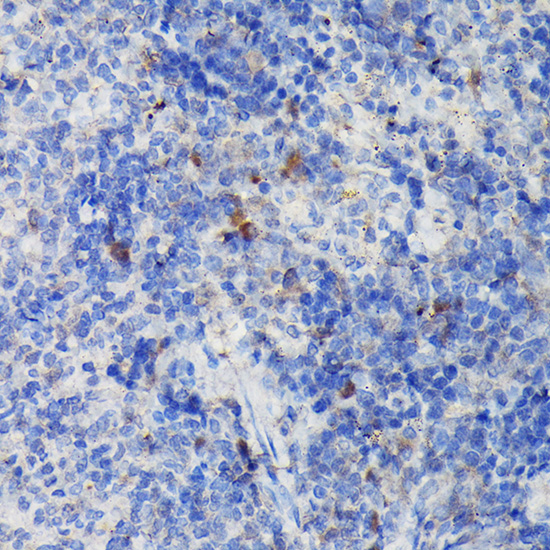 Immunohistochemistry of paraffin-embedded rat spleen using CCR3 Polyclonal Antibody at dilution of 1:100 (40x lens).Perform high pressure antigen retrieval with 10 mM citrate buffer pH 6.0 before commencing with IHC staining protocol.