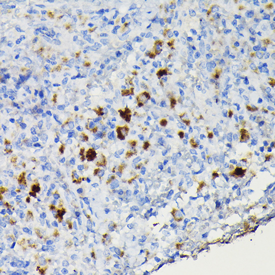 Immunohistochemistry of paraffin-embedded mouse spleen using CCR3 Polyclonal Antibody at dilution of 1:100 (40x lens).Perform high pressure antigen retrieval with 10 mM citrate buffer pH 6.0 before commencing with IHC staining protocol.