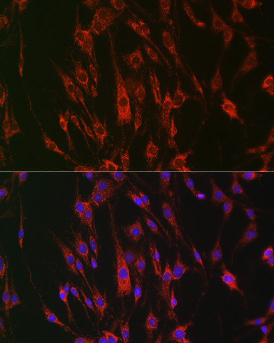 Immunofluorescence analysis of C6 cells using EPHA3/EPHA4/EPHA5 Polyclonal Antibody at dilution of 1:100 (40x lens). Blue: DAPI for nuclear staining.