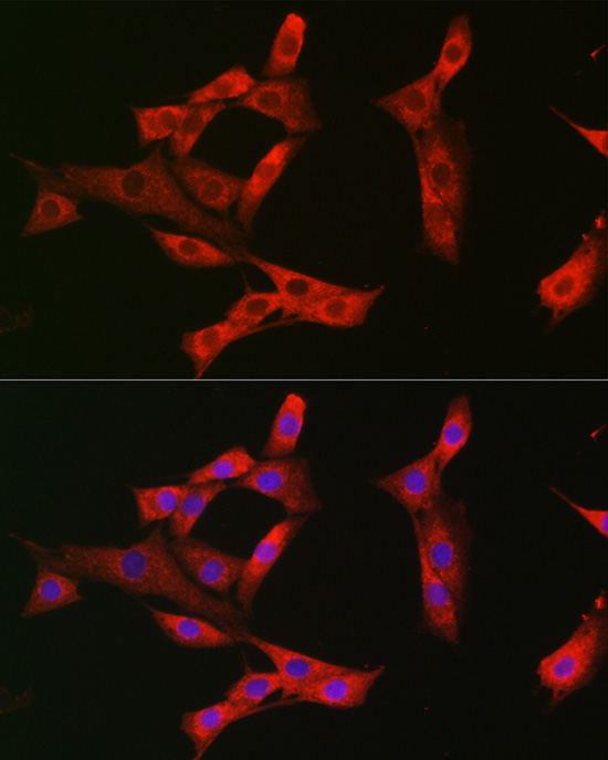 Immunofluorescence analysis of NIH/3T3 cells using EPHA3/EPHA4/EPHA5 Polyclonal Antibody at dilution of 1:100 (40x lens). Blue: DAPI for nuclear staining.