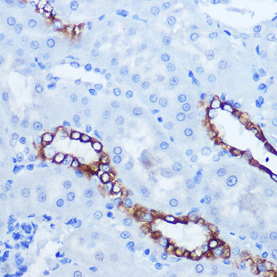 Immunohistochemistry of paraffin-embedded rat kidney using EPHA3/EPHA4/EPHA5 Polyclonal Antibody at dilution of 1:100 (40x lens).Perform microwave antigen retrieval with 10 mM Tris/EDTA buffer pH 9.0 before commencing with IHC staining protocol.