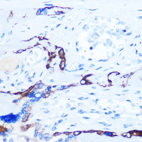 Immunohistochemistry of paraffin-embedded human placenta using EPHA3/EPHA4/EPHA5 Polyclonal Antibody at dilution of 1:100 (40x lens).Perform microwave antigen retrieval with 10 mM Tris/EDTA buffer pH 9.0 before commencing with IHC staining protocol.