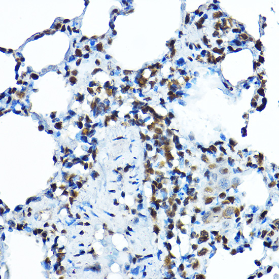 Immunohistochemistry of paraffin-embedded rat lung using BOP1 Polyclonal Antibody at dilution of 1:100 (40x lens).Perform high pressure antigen retrieval with 10 mM citrate buffer pH 6.0 before commencing with IHC staining protocol.