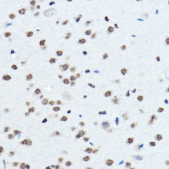 Immunohistochemistry of paraffin-embedded mouse brain using BOP1 Polyclonal Antibody at dilution of 1:100 (40x lens).Perform high pressure antigen retrieval with 10 mM citrate buffer pH 6.0 before commencing with IHC staining protocol.