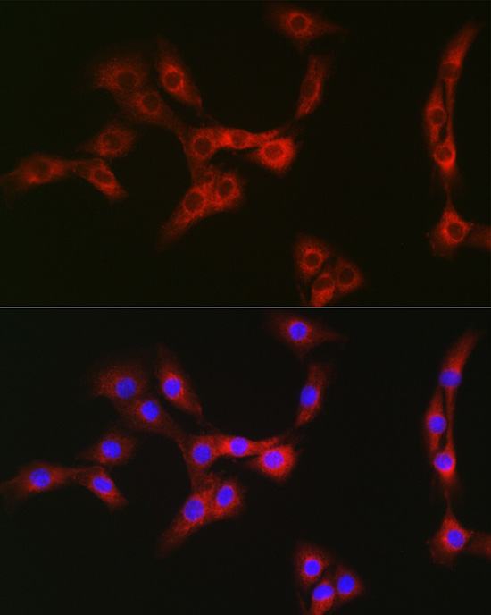 Immunofluorescence analysis of NIH/3T3 cells using Nesprin 1 Polyclonal Antibody at dilution of 1:100 (40x lens). Blue: DAPI for nuclear staining.