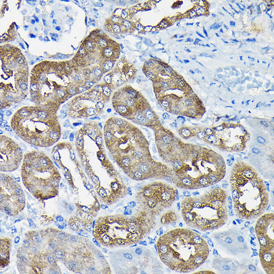 Immunohistochemistry of paraffin-embedded mouse kidney using Nesprin 1 Polyclonal Antibody at dilution of 1:100 (40x lens).Perform high pressure antigen retrieval with 10 mM citrate buffer pH 6.0 before commencing with IHC staining protocol.