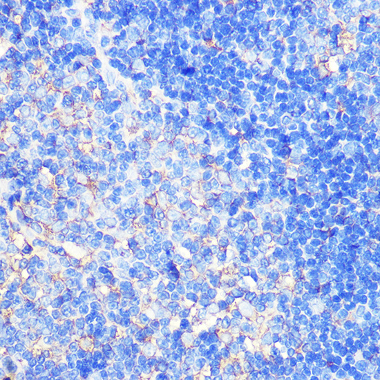 Immunohistochemistry of paraffin-embedded rat thymus using XCR1 Polyclonal Antibody at dilution of 1:100 (40x lens).Perform microwave antigen retrieval with 10 mM Tris/EDTA buffer pH 9.0 before commencing with IHC staining protocol.