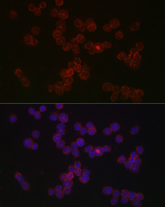 Immunofluorescence analysis of THP-1 cells using CCR5 Polyclonal Antibody at dilution of 1:50 (40x lens). Blue: DAPI for nuclear staining.