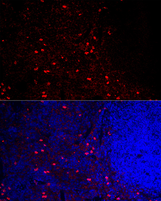 Immunofluorescence analysis of mouse spleen cells using CCR5 Polyclonal Antibody at dilution of 1:100 (40x lens). Blue: DAPI for nuclear staining.