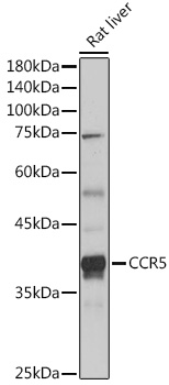 Western blot analysis of extracts of Rat liver using CCR5 Polyclonal Antibody at 1:1000 dilution.
