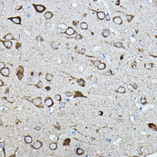 Immunohistochemistry of paraffin-embedded rat brain using KIAA0196 Polyclonal Antibody at dilution of 1:100 (40x lens).Perform high pressure antigen retrieval with 10 mM citrate buffer pH 6.0 before commencing with IHC staining protocol.