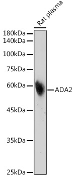 Western blot analysis of extracts of Rat plasma using ADA2 Polyclonal Antibody at 1:500 dilution.