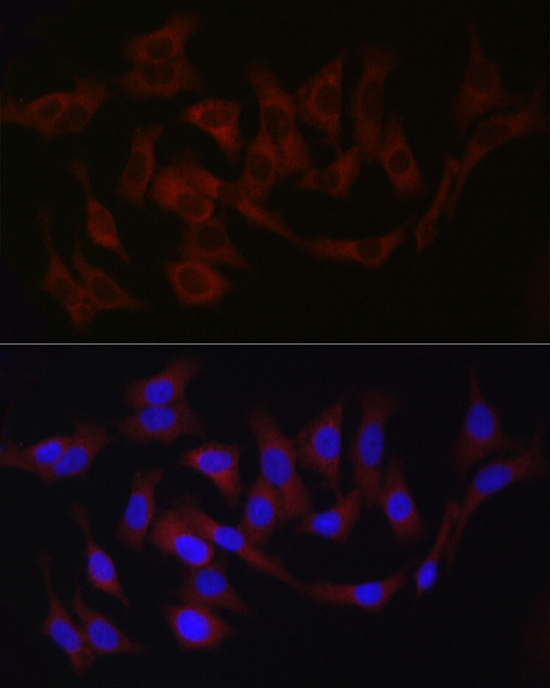 Immunofluorescence analysis of A-549 cells using Fam221a Polyclonal Antibody at dilution of 1:100 (40x lens). Blue: DAPI for nuclear staining.