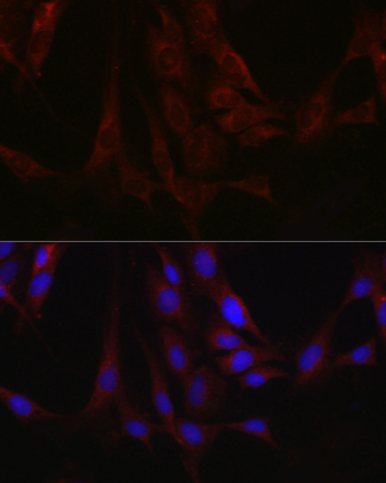 Immunofluorescence analysis of C6 cells using Fam221a Polyclonal Antibody at dilution of 1:100 (40x lens). Blue: DAPI for nuclear staining.