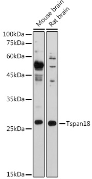 Western blot analysis of extracts of various cell lines using Tspan18 Polyclonal Antibody at 1:1000 dilution.