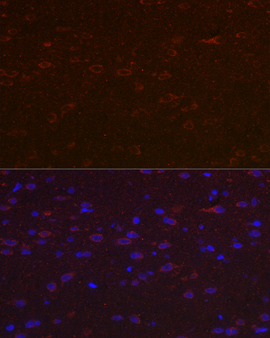 Immunofluorescence analysis of rat brain cells using Versican Polyclonal Antibody at dilution of 1:100 (40x lens). Blue: DAPI for nuclear staining.