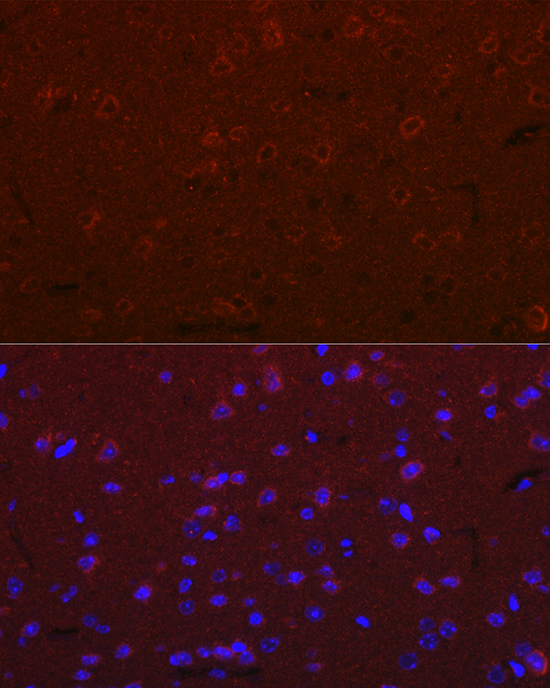 Immunofluorescence analysis of mouse brain cells using Versican Polyclonal Antibody at dilution of 1:100 (40x lens). Blue: DAPI for nuclear staining.