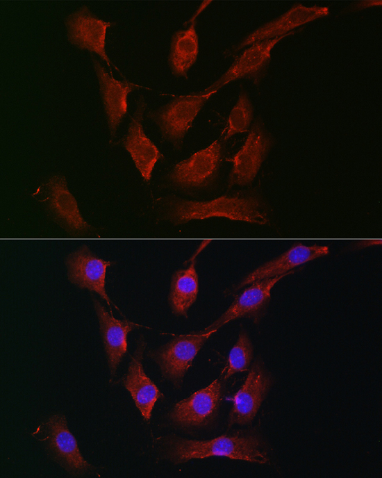 Immunofluorescence analysis of NIH-3T3 cells using RPS6KA1/RPS6KA2/RPS6KA3 Polyclonal Antibody at dilution of 1:200 (40x lens). Blue: DAPI for nuclear staining.