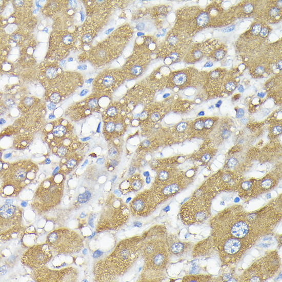 Immunohistochemistry of paraffin-embedded human liver using RPS6KA1/RPS6KA2/RPS6KA3 Polyclonal Antibody at dilution of 1:200 (40x lens).Perform high pressure antigen retrieval with 10 mM citrate buffer pH 6.0 before commencing with IHC staining protocol.