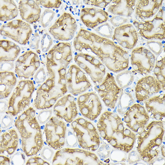 Immunohistochemistry of paraffin-embedded mouse kidney using RPS6KA1/RPS6KA2/RPS6KA3 Polyclonal Antibody at dilution of 1:200 (40x lens).Perform high pressure antigen retrieval with 10 mM citrate buffer pH 6.0 before commencing with IHC staining protocol.