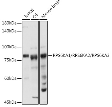 Western blot analysis of extracts of various cell lines using RPS6KA1/RPS6KA2/RPS6KA3 Polyclonal Antibody at 1:1000 dilution.