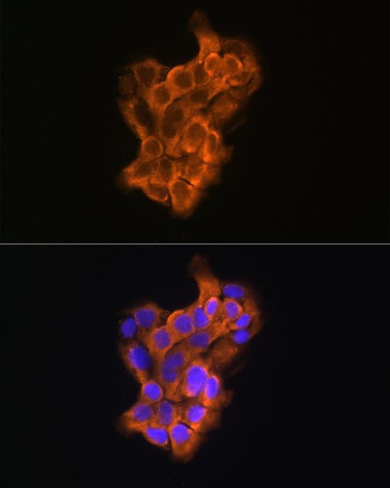 Immunofluorescence analysis of A431 cells using RAB11A/RAB11B Polyclonal Antibody at dilution of 1:100 (40x lens). Blue: DAPI for nuclear staining.