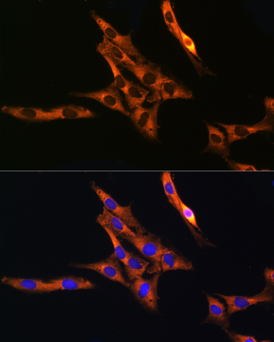 Immunofluorescence analysis of C6 cells using RAB11A/RAB11B Polyclonal Antibody at dilution of 1:100 (40x lens). Blue: DAPI for nuclear staining.