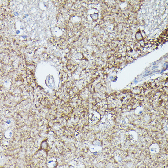 Immunohistochemistry of paraffin-embedded human brain using RAB11A/RAB11B Polyclonal Antibody at dilution of 1:100 (40x lens).Perform high pressure antigen retrieval with 10 mM citrate buffer pH 6.0 before commencing with IHC staining protocol.