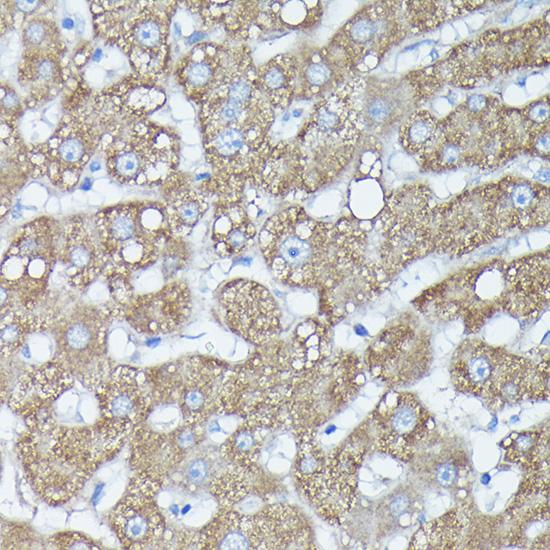 Immunohistochemistry of paraffin-embedded human liver using RAB11A/RAB11B Polyclonal Antibody at dilution of 1:100 (40x lens).Perform high pressure antigen retrieval with 10 mM citrate buffer pH 6.0 before commencing with IHC staining protocol.