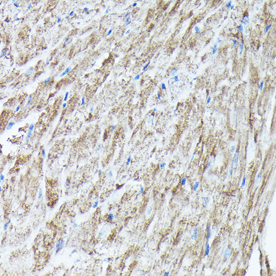 Immunohistochemistry of paraffin-embedded mouse heart using RAB11A/RAB11B Polyclonal Antibody at dilution of 1:100 (40x lens).Perform high pressure antigen retrieval with 10 mM citrate buffer pH 6.0 before commencing with IHC staining protocol.