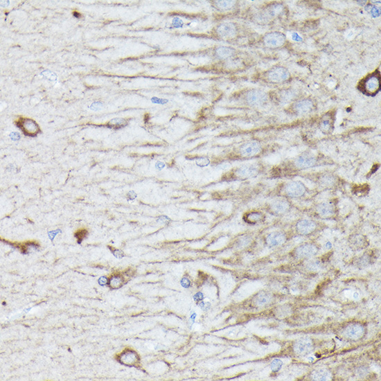 Immunohistochemistry of paraffin-embedded rat brain using RAB11A/RAB11B Polyclonal Antibody at dilution of 1:100 (40x lens).Perform high pressure antigen retrieval with 10 mM citrate buffer pH 6.0 before commencing with IHC staining protocol.