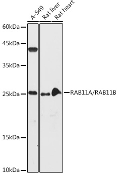 Western blot analysis of extracts of various cell lines using RAB11A/RAB11B Polyclonal Antibody at 1:1000 dilution.