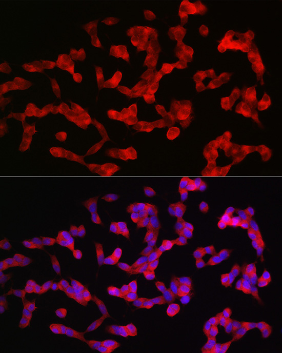 Immunofluorescence analysis of SH-SY5Y cells using ANK3 Polyclonal Antibody at dilution of 1:100 (40x lens). Blue: DAPI for nuclear staining.