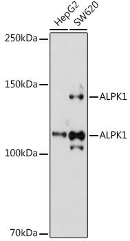 Western blot analysis of extracts of various cell lines using ALPK1 Polyclonal Antibody at 1:1000 dilution.