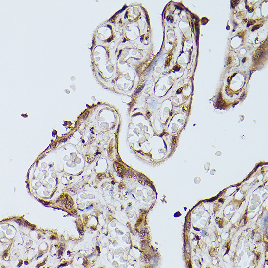 Immunohistochemistry of paraffin-embedded human placenta using Slc39a11 Polyclonal Antibody at dilution of 1:100 (40x lens).Perform high pressure antigen retrieval with 10 mM citrate buffer pH 6.0 before commencing with IHC staining protocol.