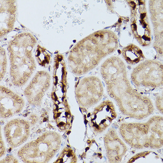 Immunohistochemistry of paraffin-embedded mouse kidney using Slc39a11 Polyclonal Antibody at dilution of 1:100 (40x lens).Perform high pressure antigen retrieval with 10 mM citrate buffer pH 6.0 before commencing with IHC staining protocol.