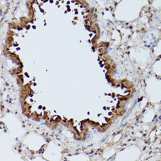 Immunohistochemistry of paraffin-embedded mouse lung using Slc39a11 Polyclonal Antibody at dilution of 1:100 (40x lens).Perform high pressure antigen retrieval with 10 mM citrate buffer pH 6.0 before commencing with IHC staining protocol.