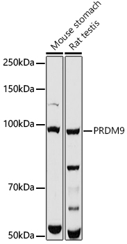 Western blot analysis of extracts of various cell lines using PRDM9 Polyclonal Antibody at 1:1000 dilution.