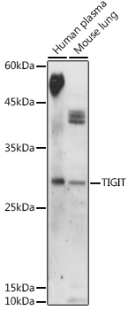 Western blot analysis of extracts of various cell lines using TIGIT Polyclonal Antibody at 1:1000 dilution.