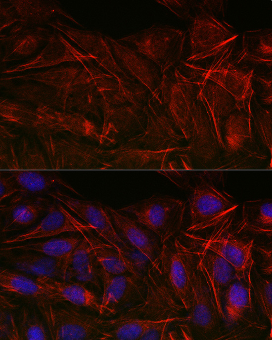 Immunofluorescence analysis of U2OS cells using CNN3 Polyclonal Antibody at dilution of 1:50 (40x lens). Blue: DAPI for nuclear staining.