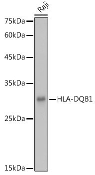 Western blot analysis of extracts of Raji cells using HLA-DQB1 Polyclonal Antibody at 1:1000 dilution.