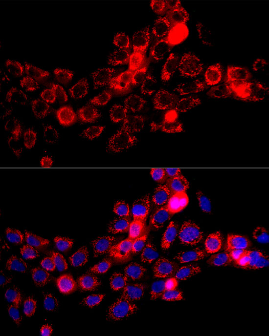 Immunofluorescence analysis of A-431 cells using DBT Polyclonal Antibody at dilution of 1:100 (40x lens). Blue: DAPI for nuclear staining.