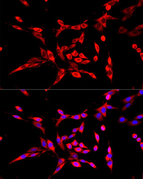 Immunofluorescence analysis of PC-12 cells using DBT Polyclonal Antibody at dilution of 1:100 (40x lens). Blue: DAPI for nuclear staining.