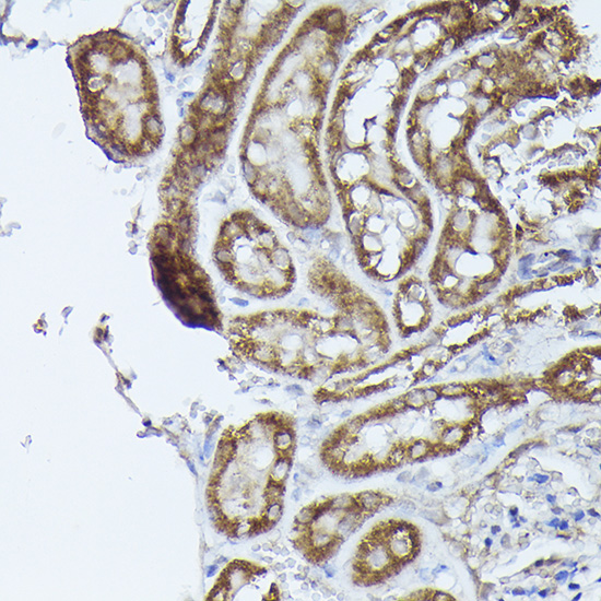 Immunohistochemistry of paraffin-embedded mouse kidney using DBT Polyclonal Antibody at dilution of 1:50 (40x lens).Perform high pressure antigen retrieval with 10 mM citrate buffer pH 6.0 before commencing with IHC staining protocol.